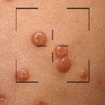 First Derm Dermatology Online Android App Review